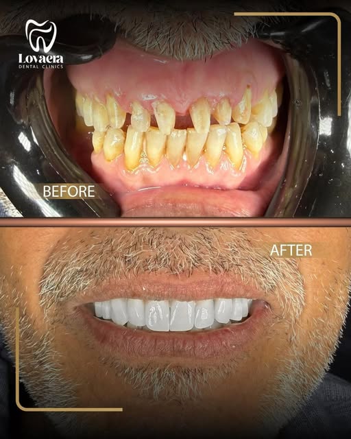 589908006_17867331696505422_4317474596915999537_n 589908006_17867331696505422_4317474596915999537_n