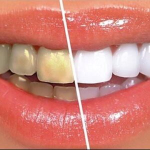 97077aafe1c817cbff8e5470931c7257