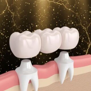 تركيبات الأسنان الثابتة